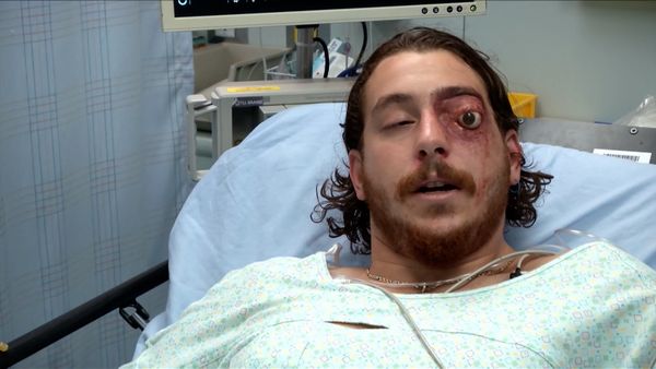 Untold Stories of the ER - Don't Push It
