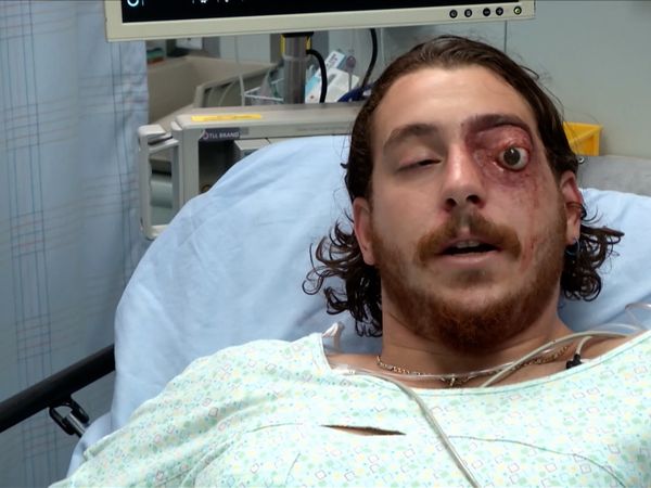 Untold Stories of the ER - Don't Push It