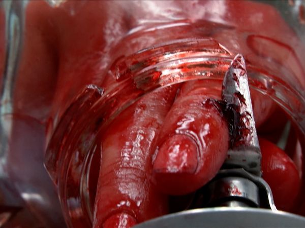 Untold Stories of the ER - Twist & Shout