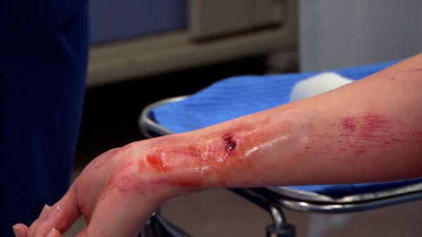 Untold Stories of the ER - Frozen