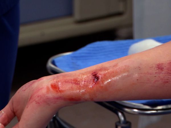 Untold Stories of the ER - Frozen