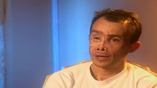 Amazing Medical Stories - Rebuilding Lives