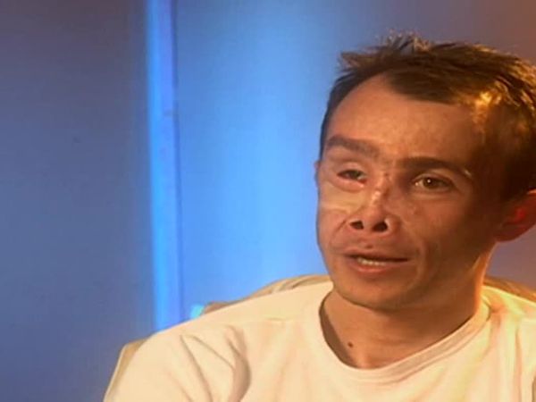 Amazing Medical Stories - Rebuilding Lives