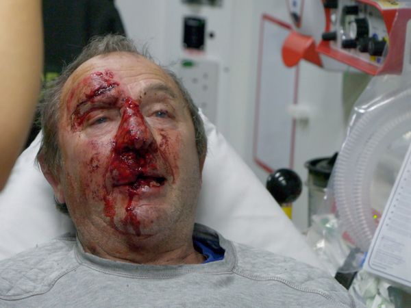 Ambulance: Code Red - Episode 3