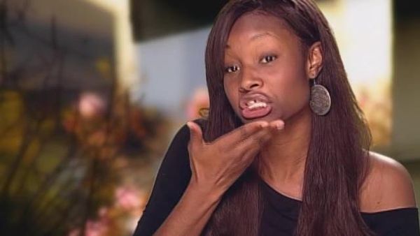 America's Next Top Model - The Girl Who Has Surgery