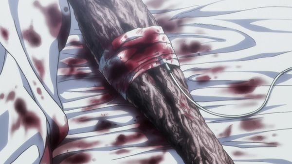 Hunter x Hunter LT - Derrota x Y x Reunión