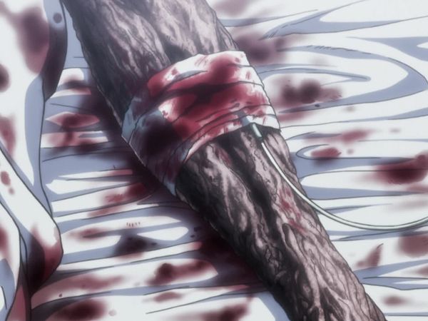 Hunter x Hunter LT - Derrota x Y x Reunión