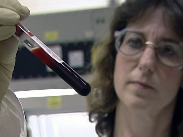 Diagnosis: Unknown - Sangre Contaminada