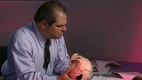 Medical Detectives - Saving Face