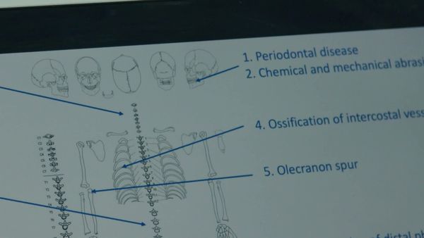 Expert Witness - Pollen, bones and DNA