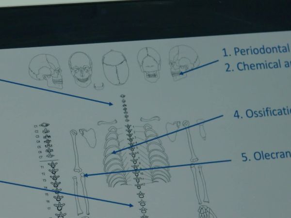 Expert Witness - Pollen, bones and DNA
