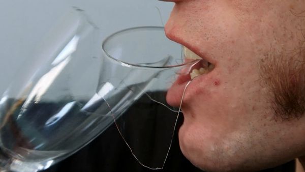 My Strange Addiction - Eats Glass/Bleaches Skin