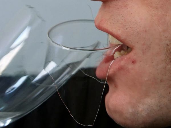 My Strange Addiction - Eats Glass/Bleaches Skin