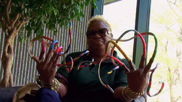 My Strange Addiction - Rampant Rats/Extreme Fingernails