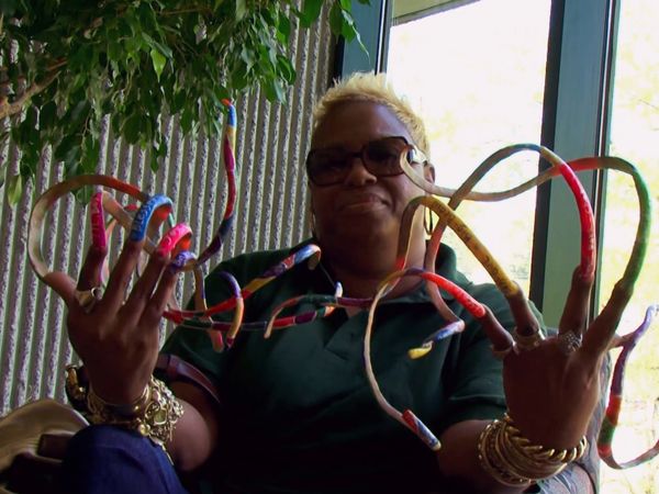 My Strange Addiction - Rampant Rats/Extreme Fingernails