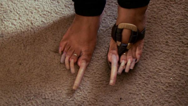My Strange Addiction - Eats Dirt/Extreme Toenails