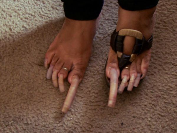 My Strange Addiction - Eats Dirt/Extreme Toenails