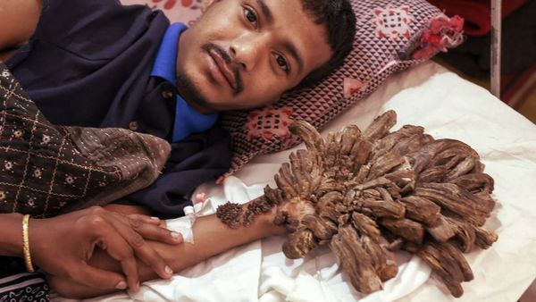 Top 10 Secrets and Mysteries - Misterios Médicos