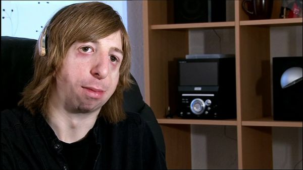 Embarrassing Bodies - Weston / Breasts