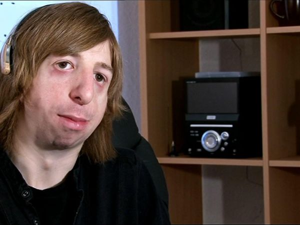 Embarrassing Bodies - Weston / Breasts