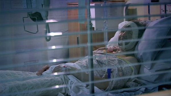 Embarrassing Bodies - Revisit - About The Face