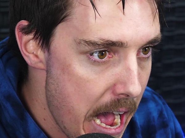 LazarBeam - I Broke My Kill Record / I Broke Every Kill Record