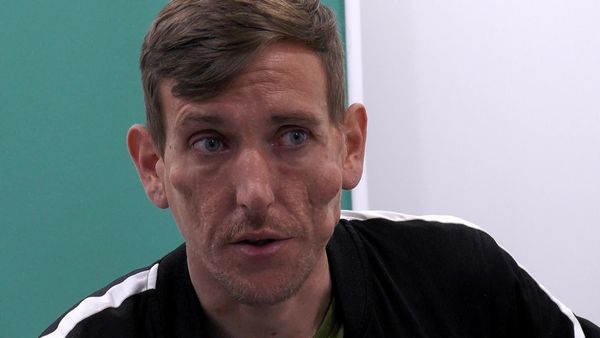 Skin A&E - Episode 1