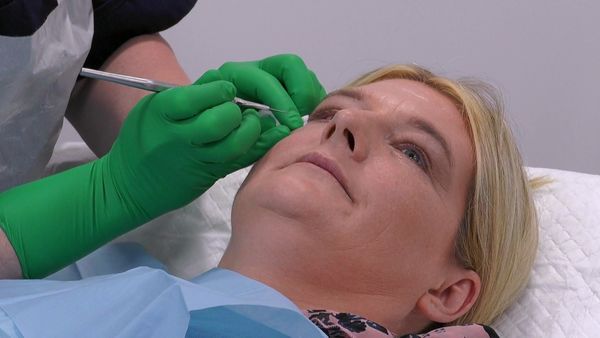Skin A&E - Episode 3
