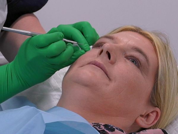 Skin A&E - Episode 3