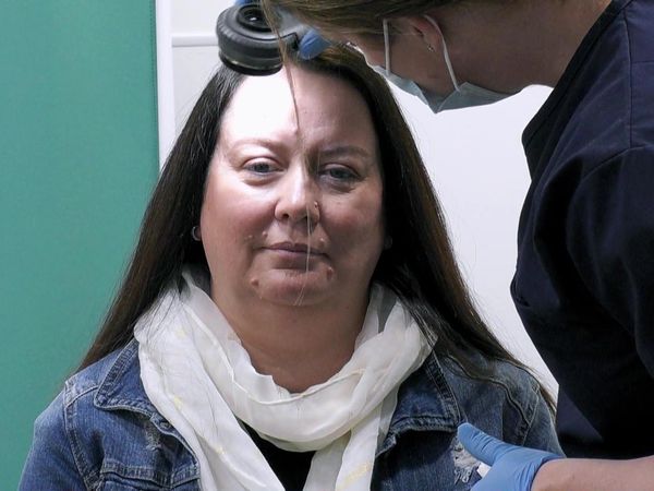Skin A&E - Episode 8