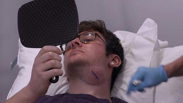 Skin A&E - Episode 4