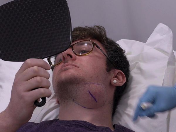Skin A&E - Episode 4