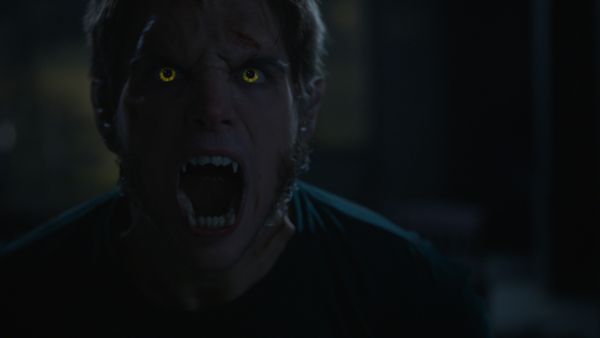 Teen Wolf - Status Asthmaticus