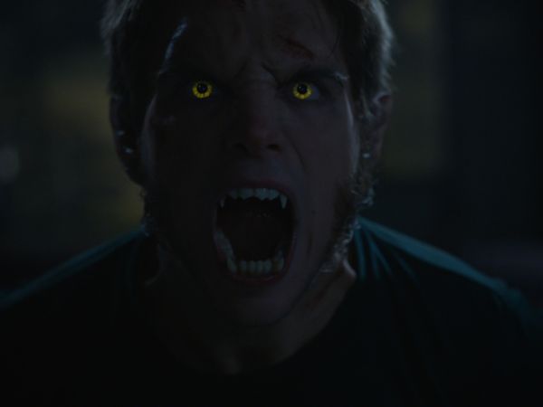 Teen Wolf - Status Asthmaticus