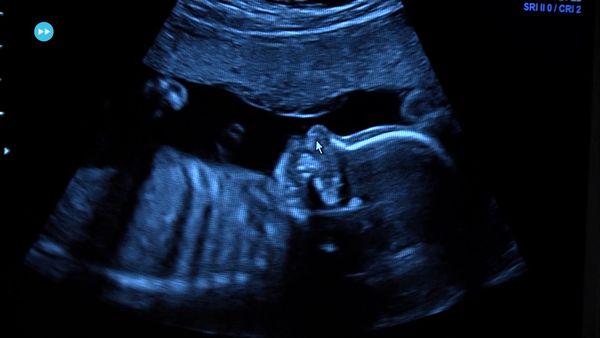Skuld - Ultrasound + Healthy food