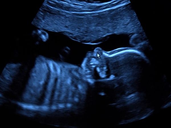 Skuld - Ultrasound + Healthy food