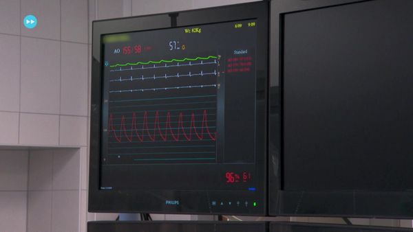 Skuld - Stent and X-Ray
