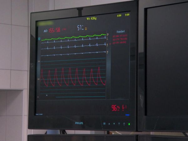 Skuld - Stent and X-Ray