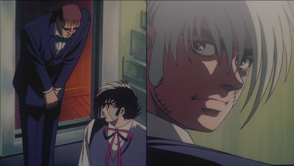 Black Jack (the Complete OVA Series) - The Carbuncle with a Human Face