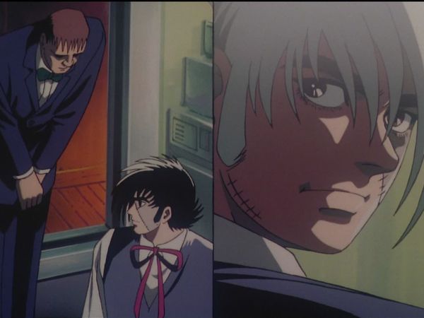Black Jack (the Complete OVA Series) - The Carbuncle with a Human Face