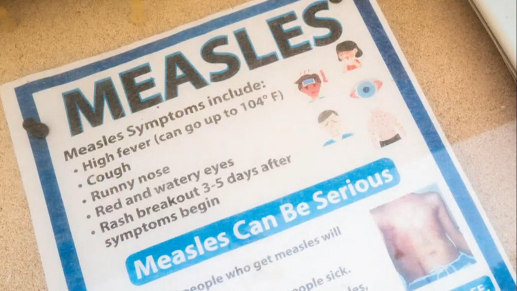 Watch CBS Mornings U.S. risks losing measles elimination status ...